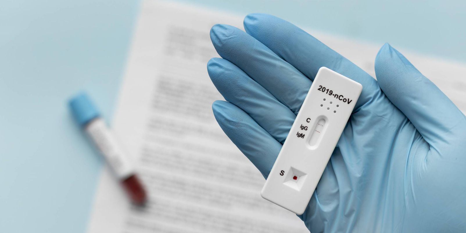 Ist ein Covid-Test sicher?