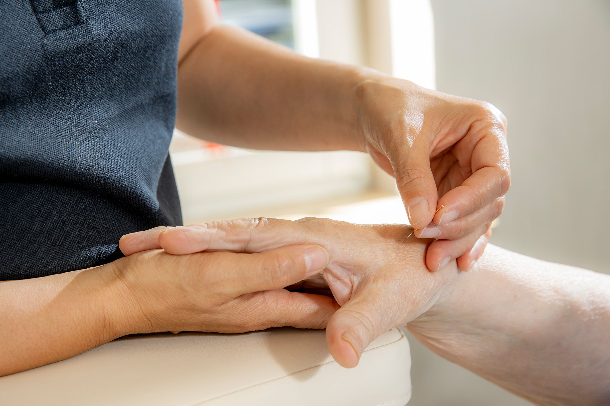 Gesundheitszentrum Helenenquelle. Akupunktur einer Hand.
