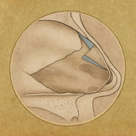 Illustration eines subdorsal-Z