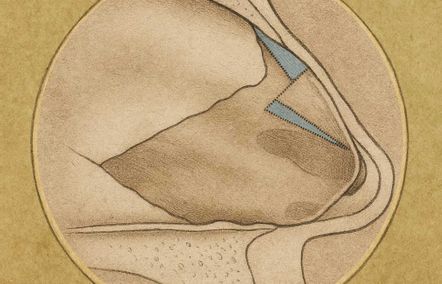 Illustration eines subdorsal-Z