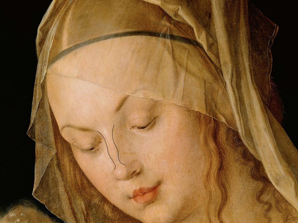 Albrecht Dürers Gemälde „Maria mit der Birnenschnitte“ zeigt harmonisch geschwungene Nasenrückenlinien im Profil – ein Vorbild für moderne Nasenästhetik.