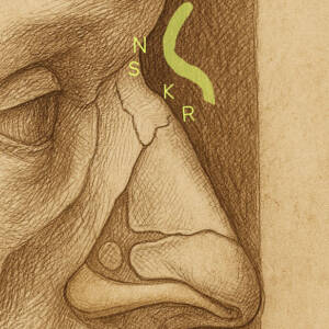 Anatomische Illustration einer S‑förmigen Höckernase im Profil. Beschriftet sind Nasion (N), Kyphion (K) und Rhinion (R).