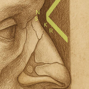 Anatomische Illustration einer V‑förmigen Höckernase im Profil. Beschriftet sind Nasion (N) und Rhinion (R); kein Kyphion vorhanden.