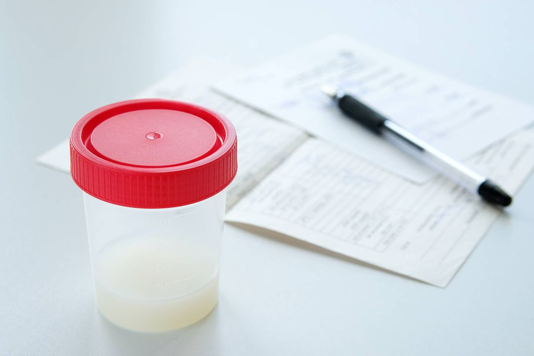 Semen analysis in a medical tank labeled in English and completed forms, on a white background. Donor sperm for artificial fertilization, infertility treatment, planning of children.